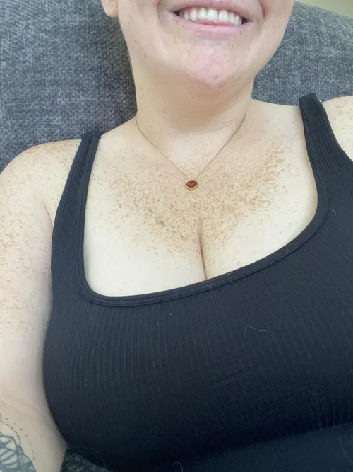 My freckles contrast against my skin so nicely, don’t they?