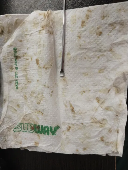 A Week's worth of ear wax scooped out and cleaned with this tissue.