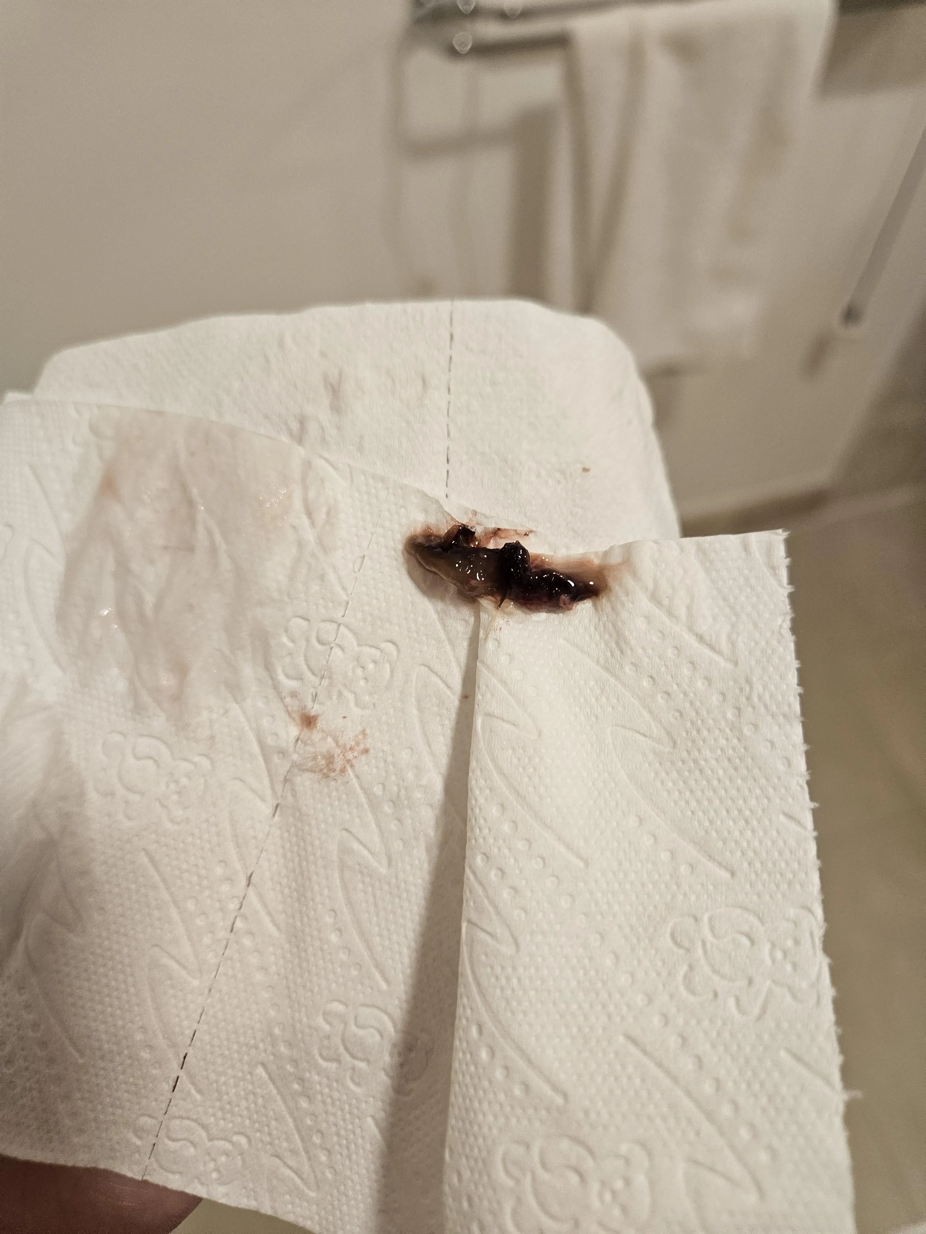 ive had this weird thing stuck in my nose and came out like this