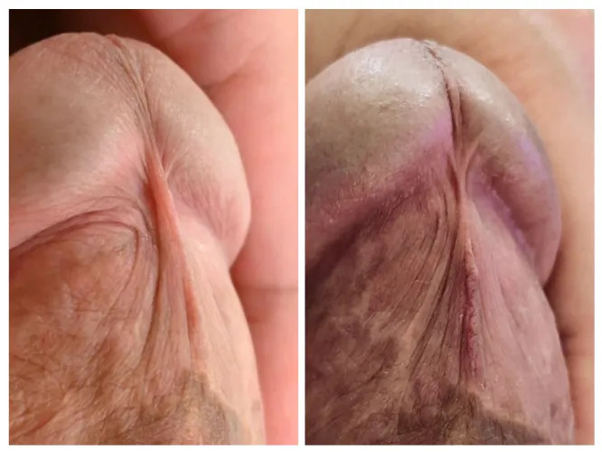 after one tie. might do more