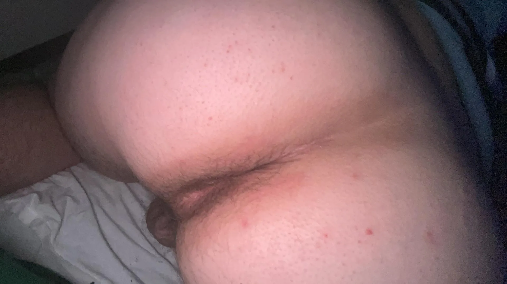 Carnival dream rn M4A