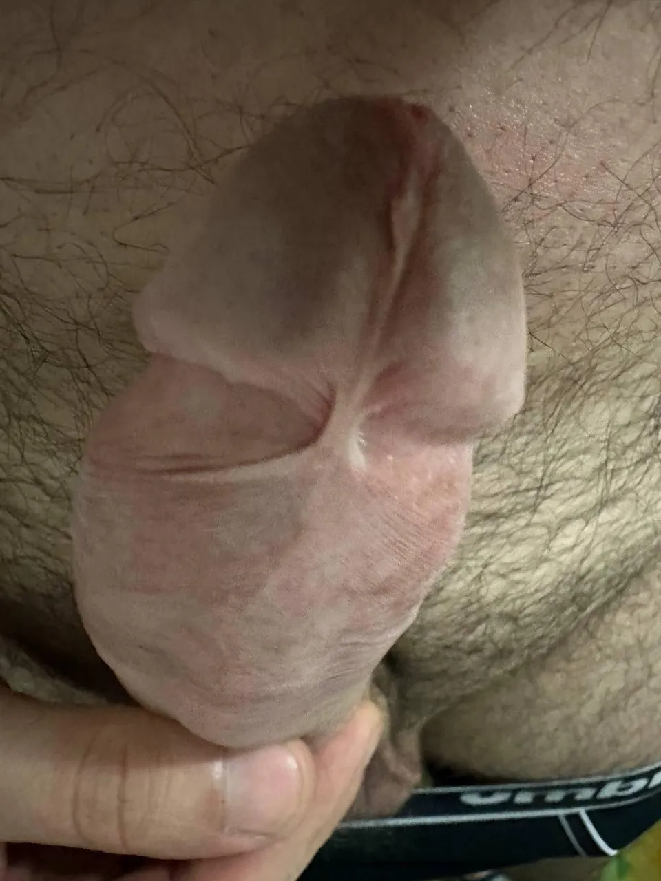 How can I cut my frenulum?