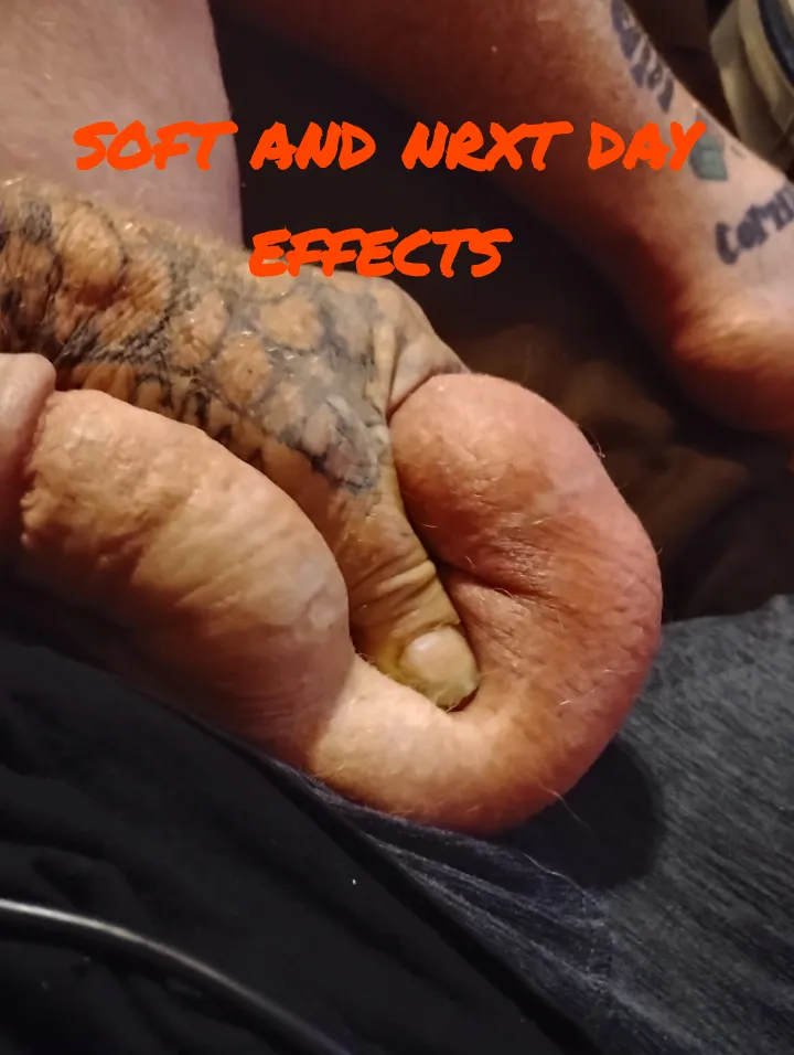 The day after pumping picture. He's completely soft also.Lmk what y'all think