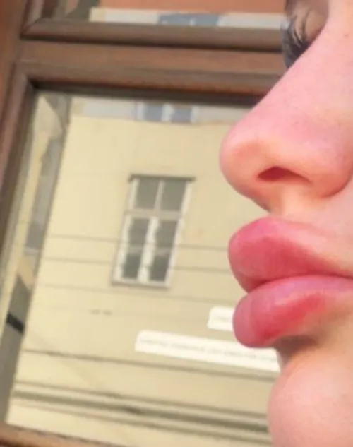 5ml, freshly filled yesterday