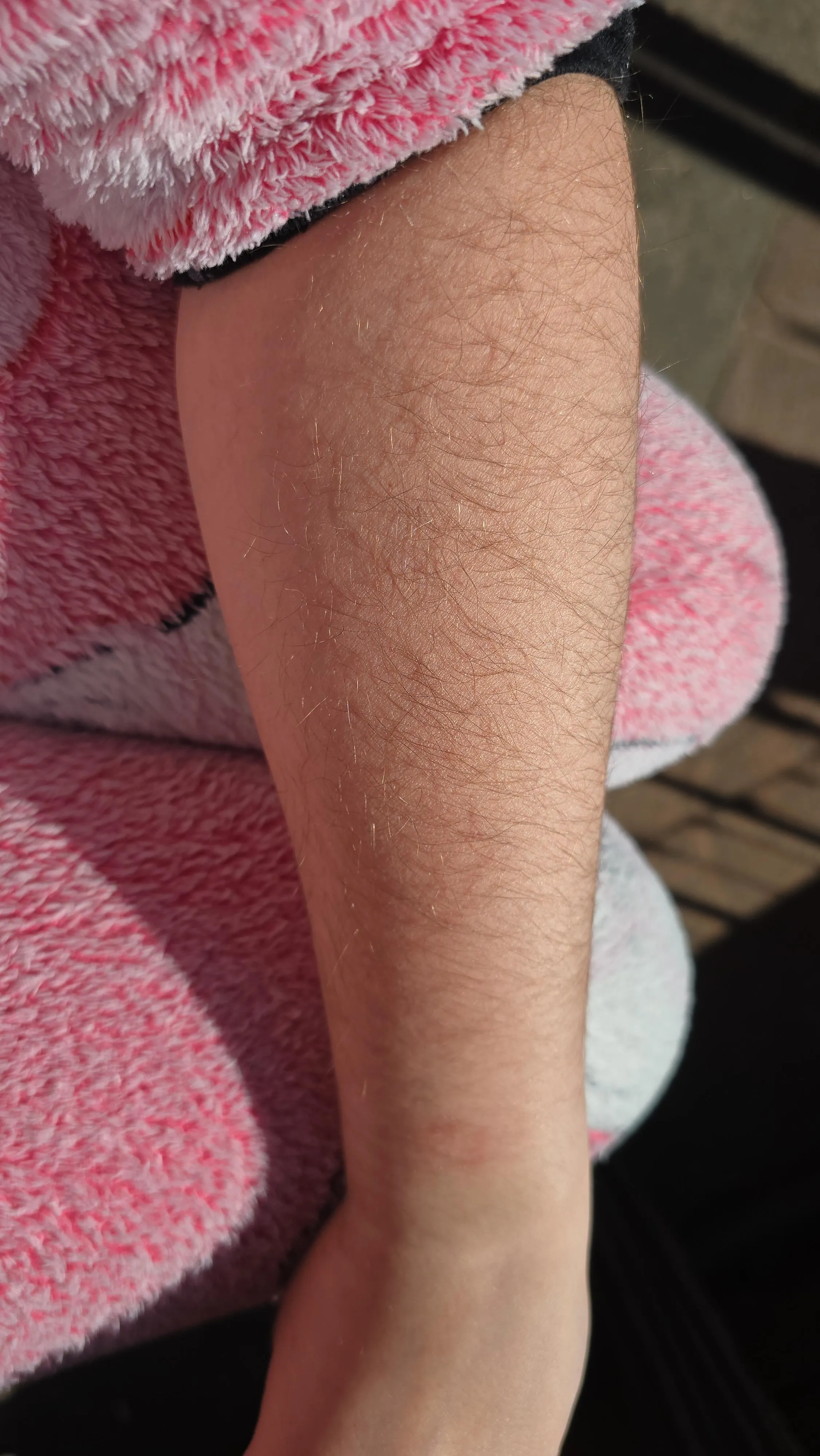 I just love how they look in the sun my [arms]