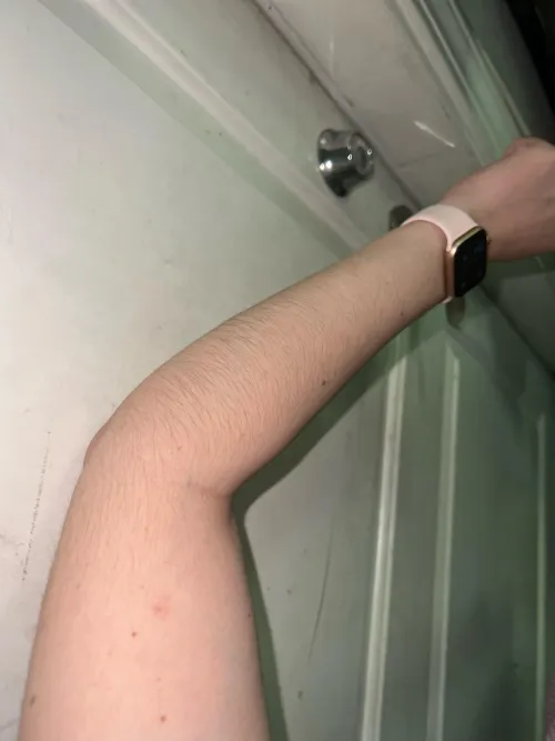 I love how thick the hair on my [arms] is getting!