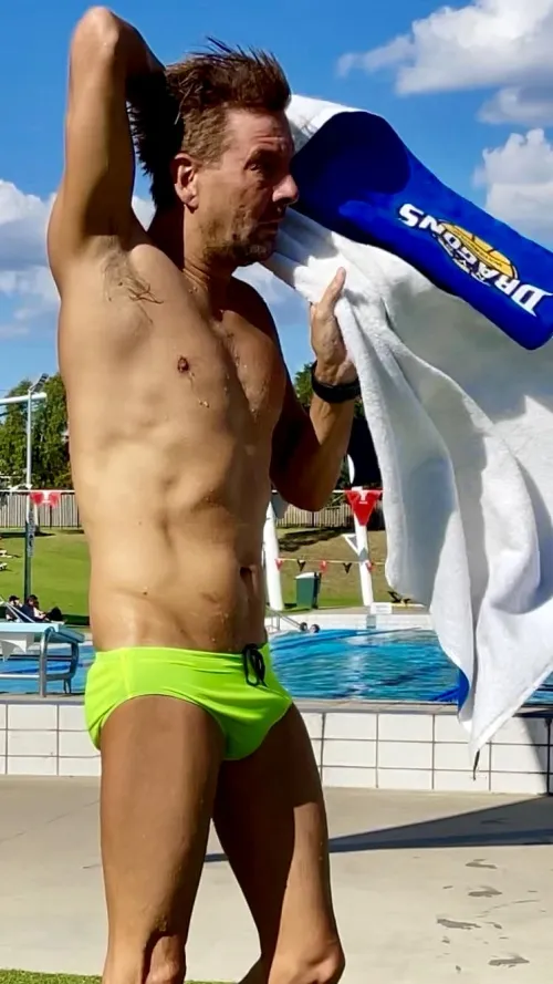 Can speedos be too yellow?