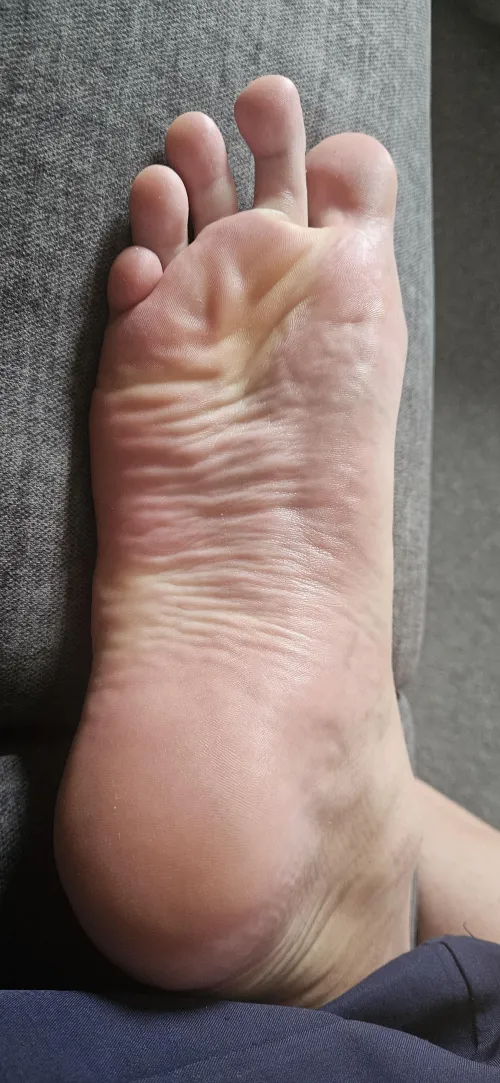 How many wrinkles can you count?