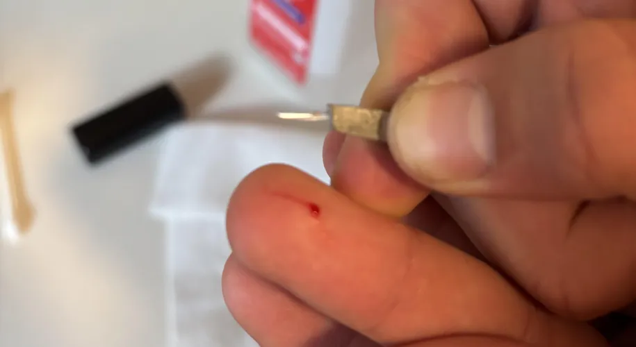 Cleaning my cracked phone screen with a wipe. Perfect sliver in my fingertip.