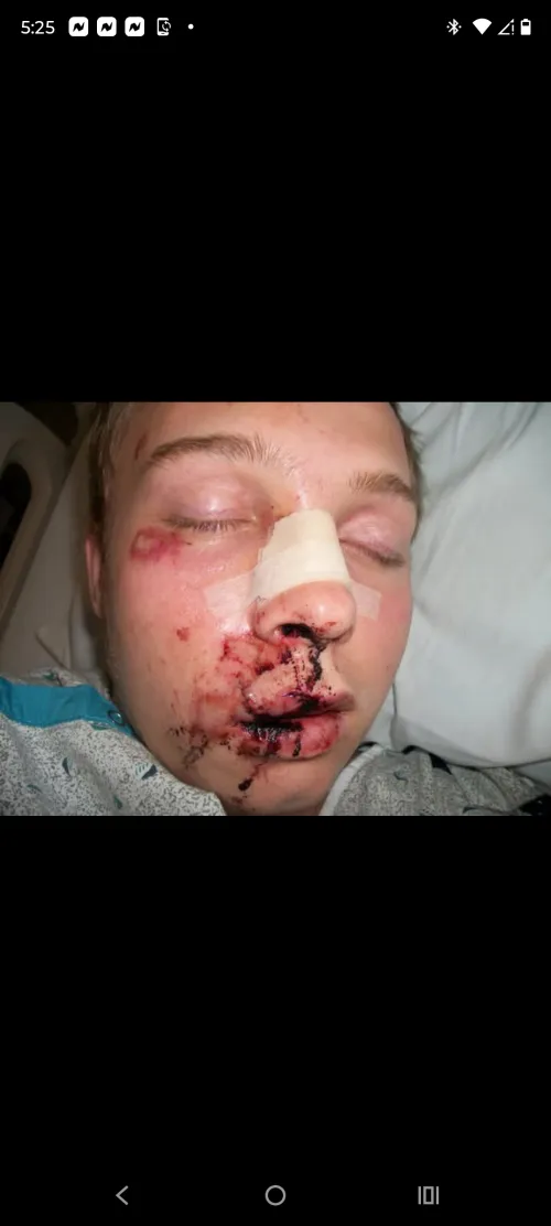 First and last time attempting a dirt jump on BMX bike