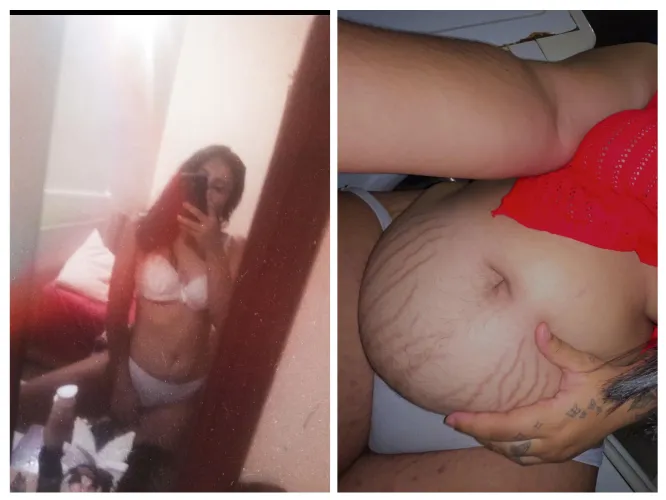 I'd rather be fat and have thousands of rolls than have a smooth belly