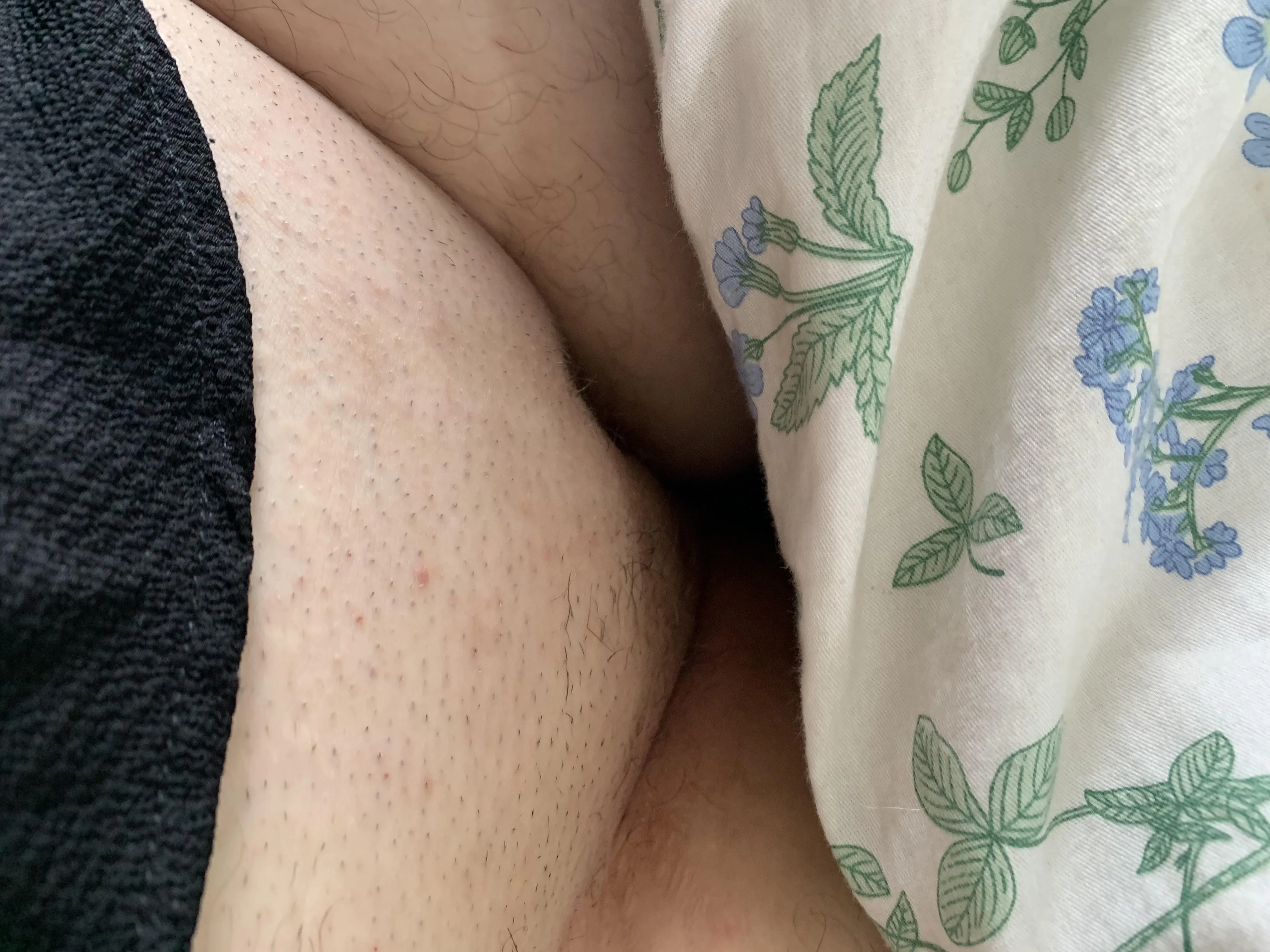 Meets in Kirkcaldy NOW !! Dm me