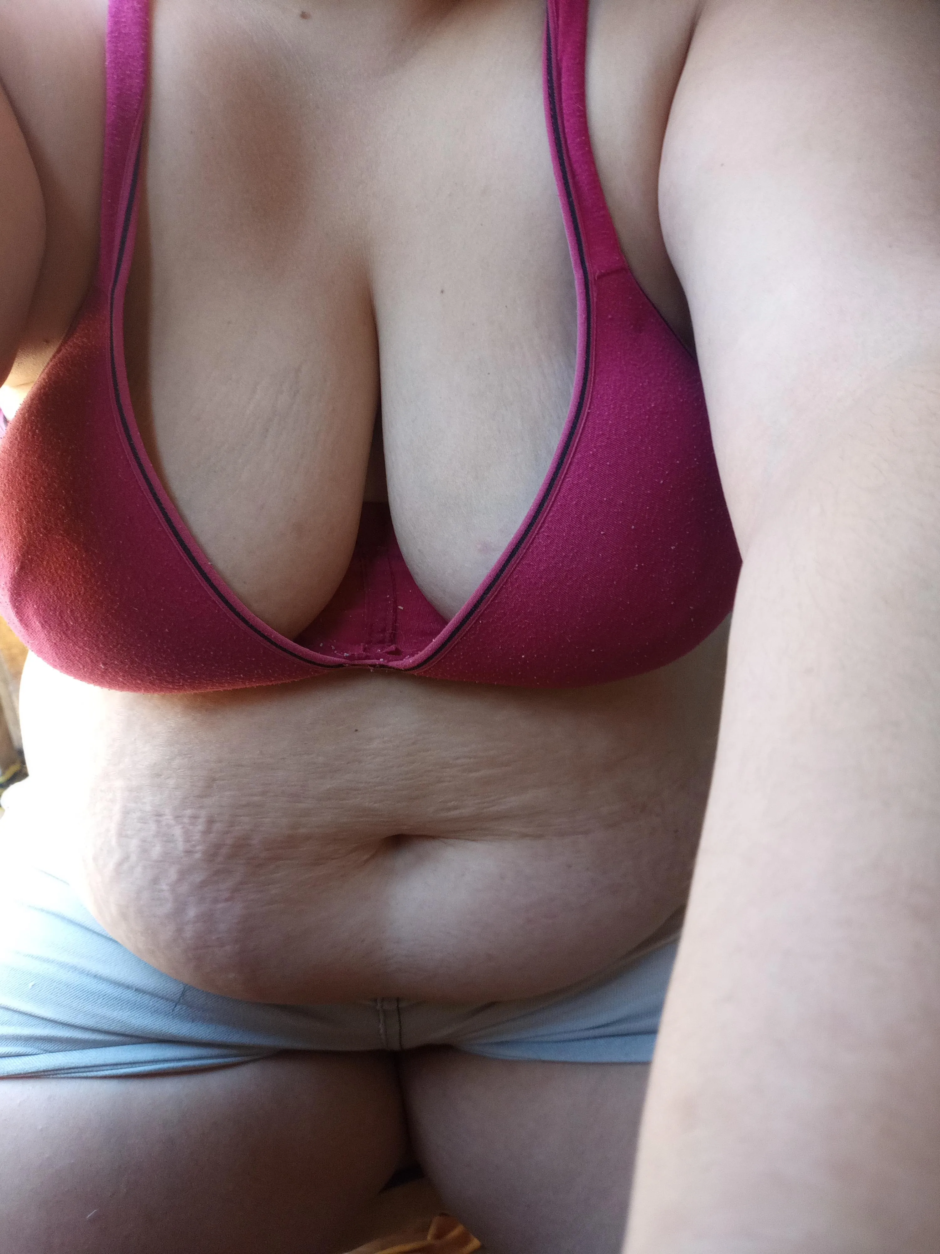 Which stretch marks do you like best? Boobs or belly?