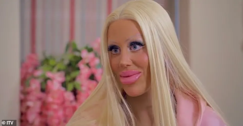 Apparently she spent £250,000 to look like this.