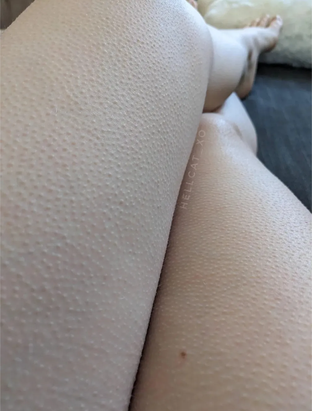 sometimes I get goosebumps when I sneeze