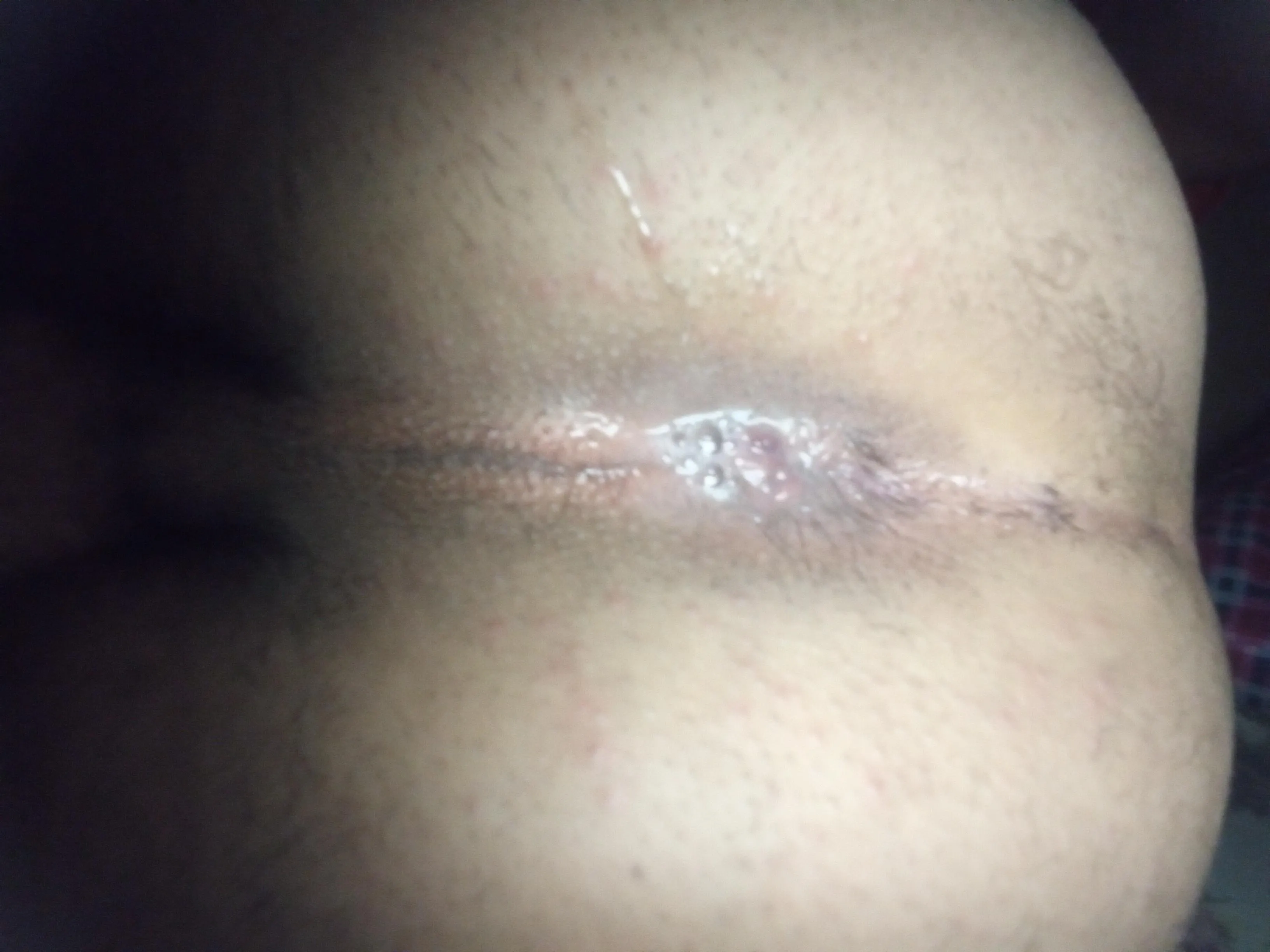 Procurando alguém para me fazer de CUMMDUMP.(ACEITO DM)