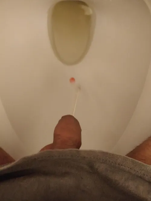 I feel like having to pee all the time, since I got cathed 😳