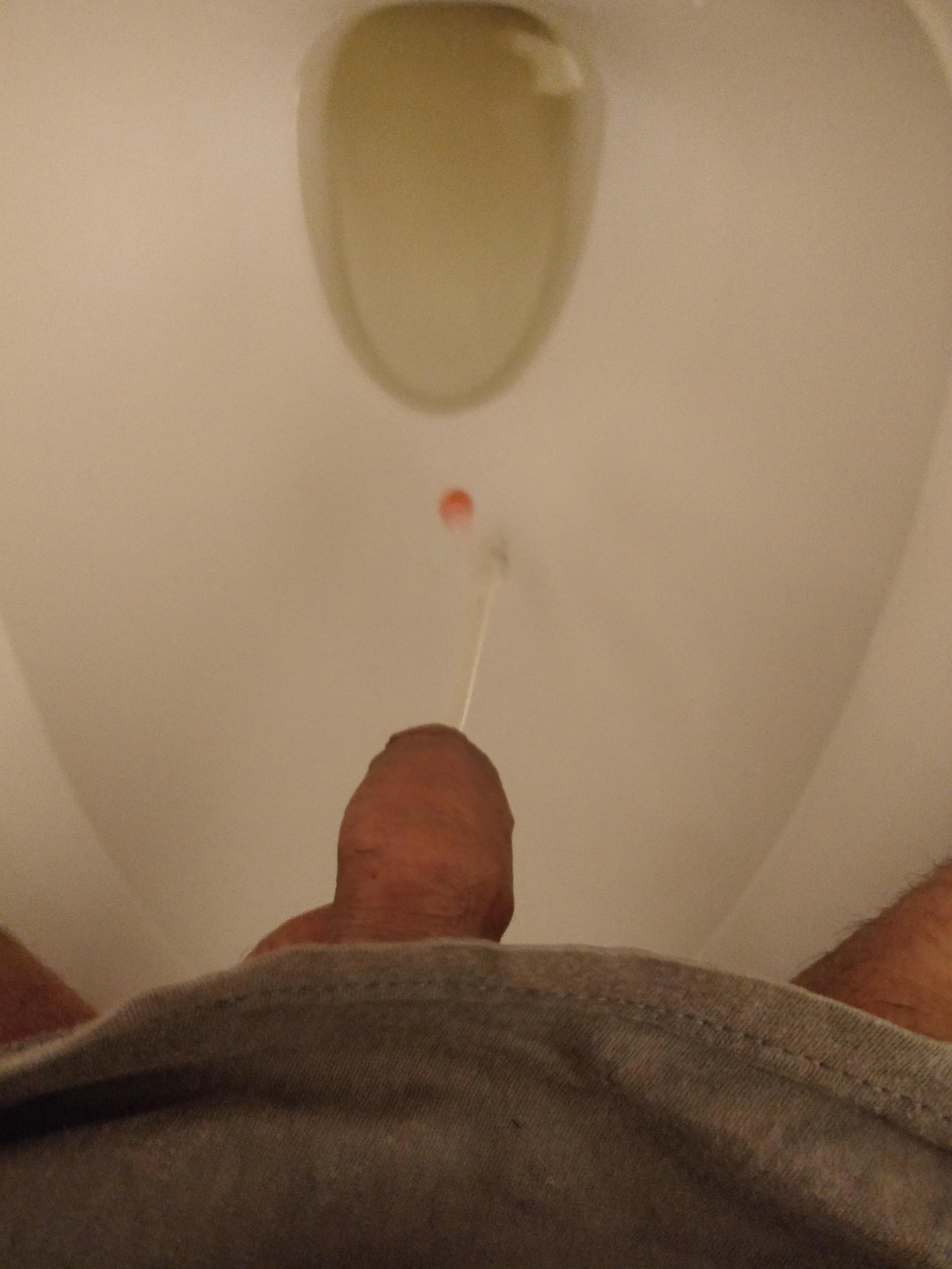 I feel like having to pee all the time, since I got cathed 😳