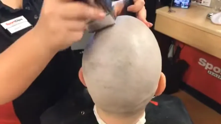 What do you think about the paleness of the skin on the head?