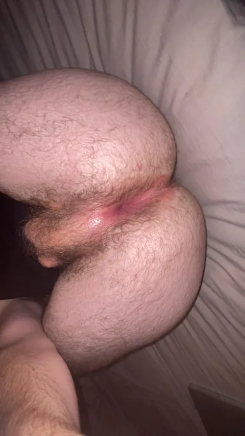(22) my hairy otter butthole :p