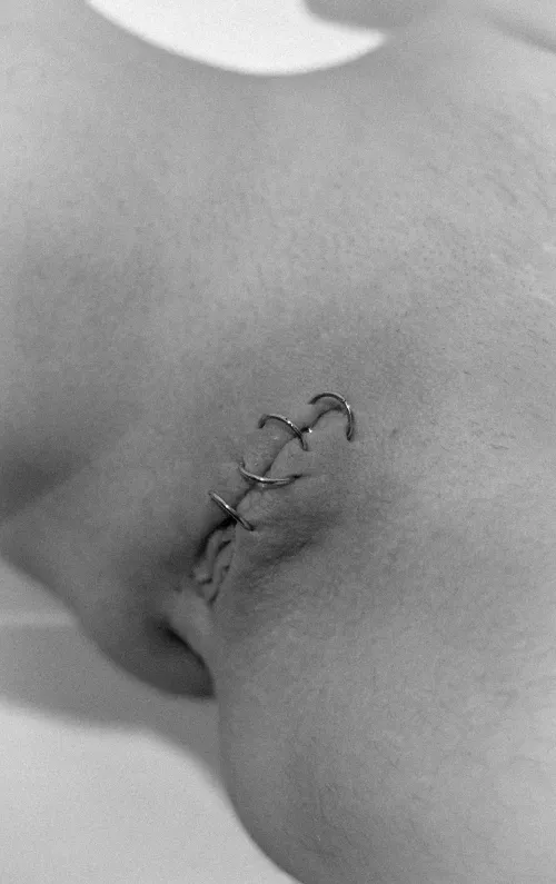 pussy sealed permanently