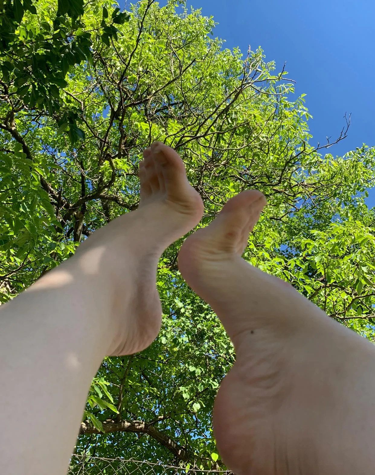 high arches