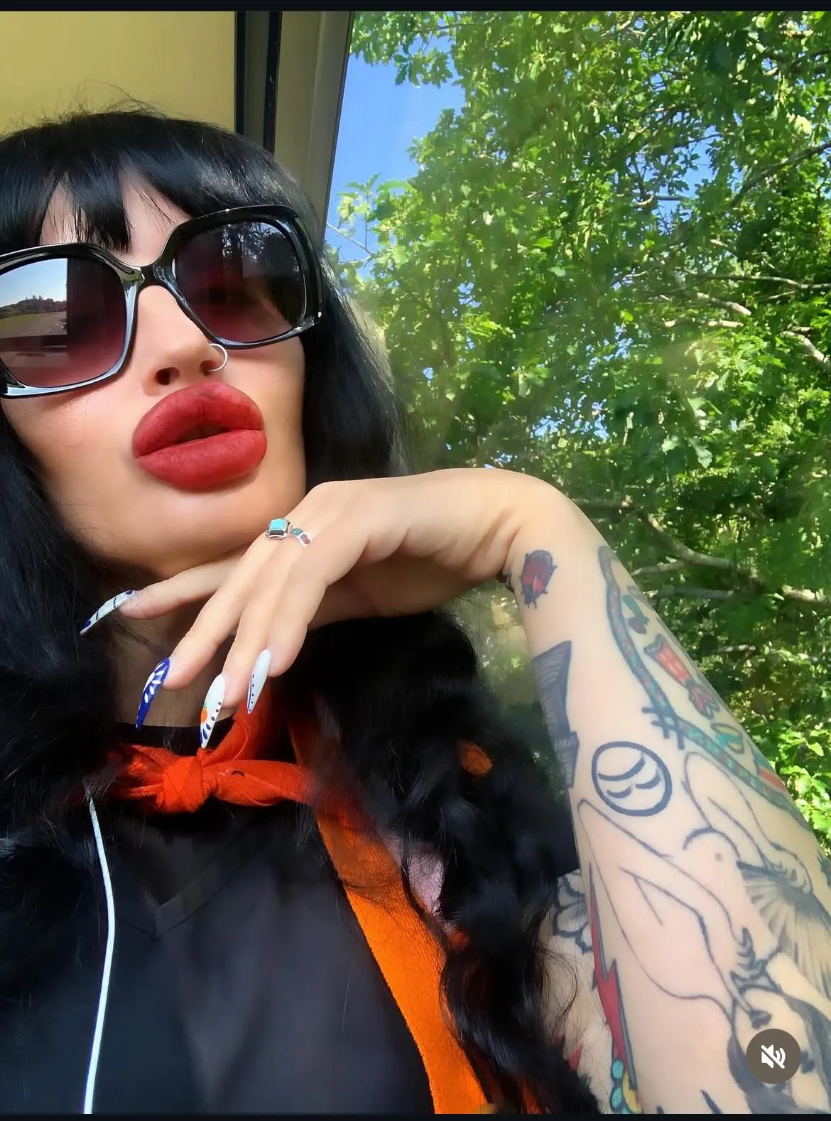 I fill up my gf lips 3ml a month should we do more