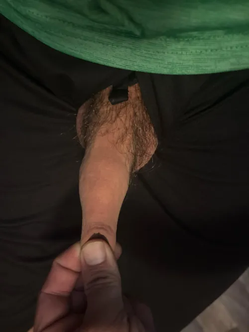 My over hang restored foreskin