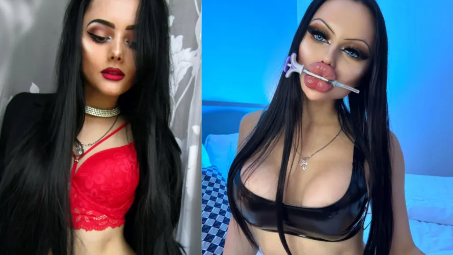 Do you prefer before or after ?