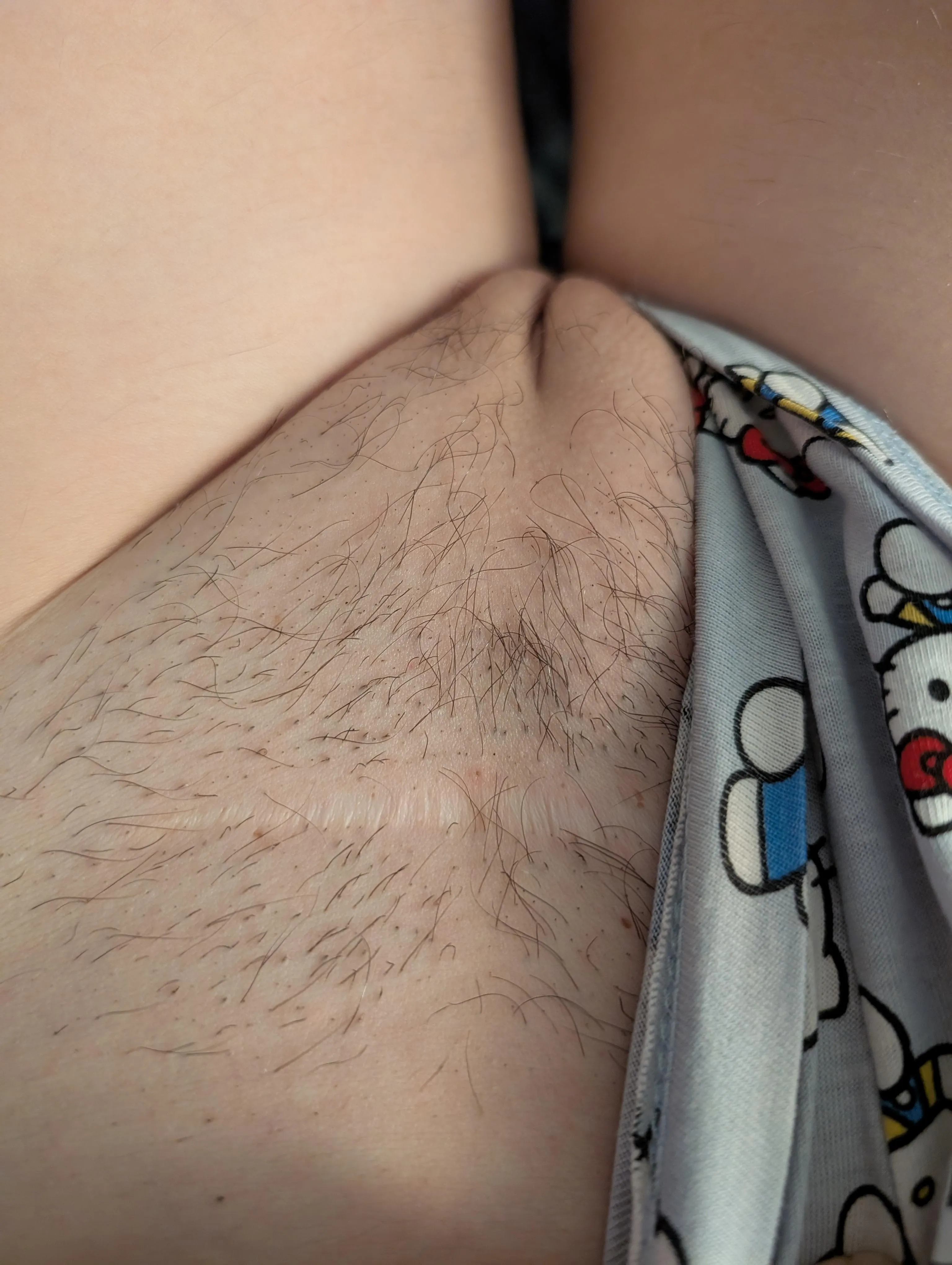 Halfway regrowth, last wax was around one month ago