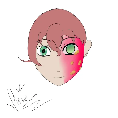 Fresh burns practice, any suggestion?