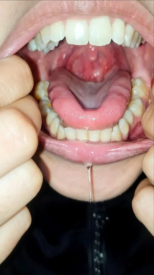 Don't look into my throat too long… you might fall in.