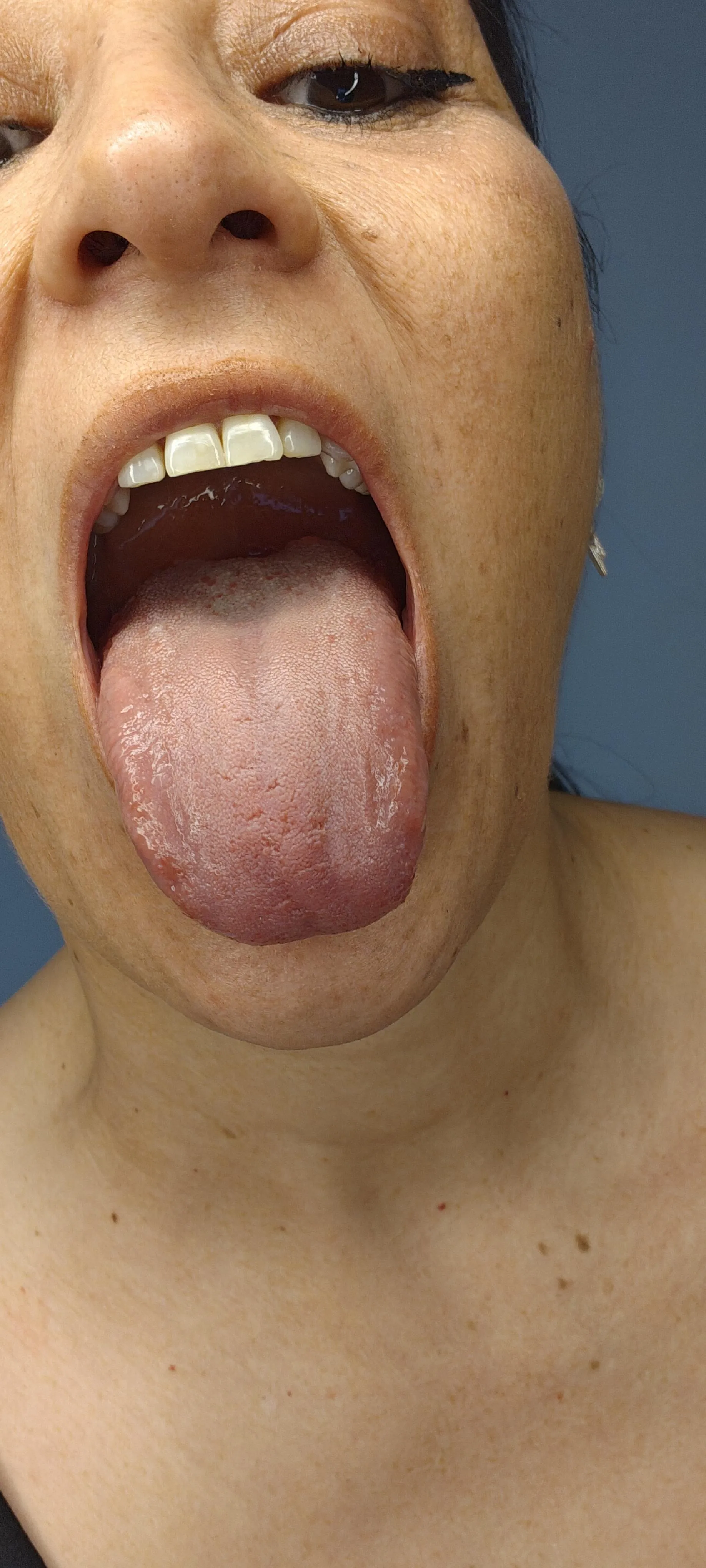 I will slowly swallow you...