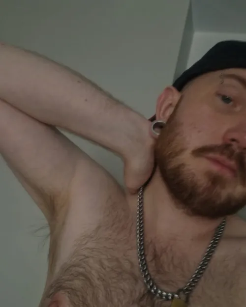 My armpit, not so much hair. My fur is on my chest