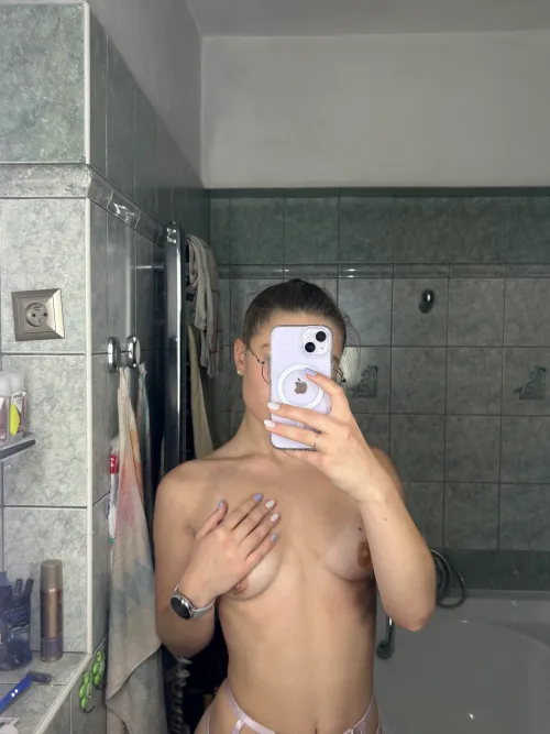 My body missing bites and kisses