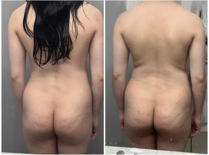 Y’all see the start of the back rolls too 🥹 Goodbyeee fit young body