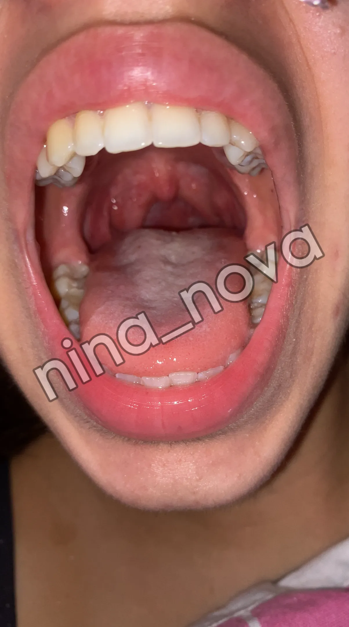 You got three seconds to jump there