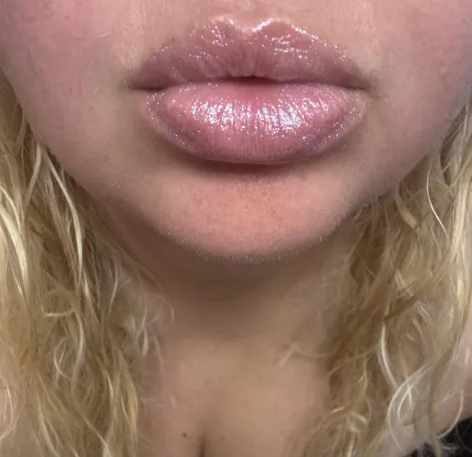 All that glittery gloss