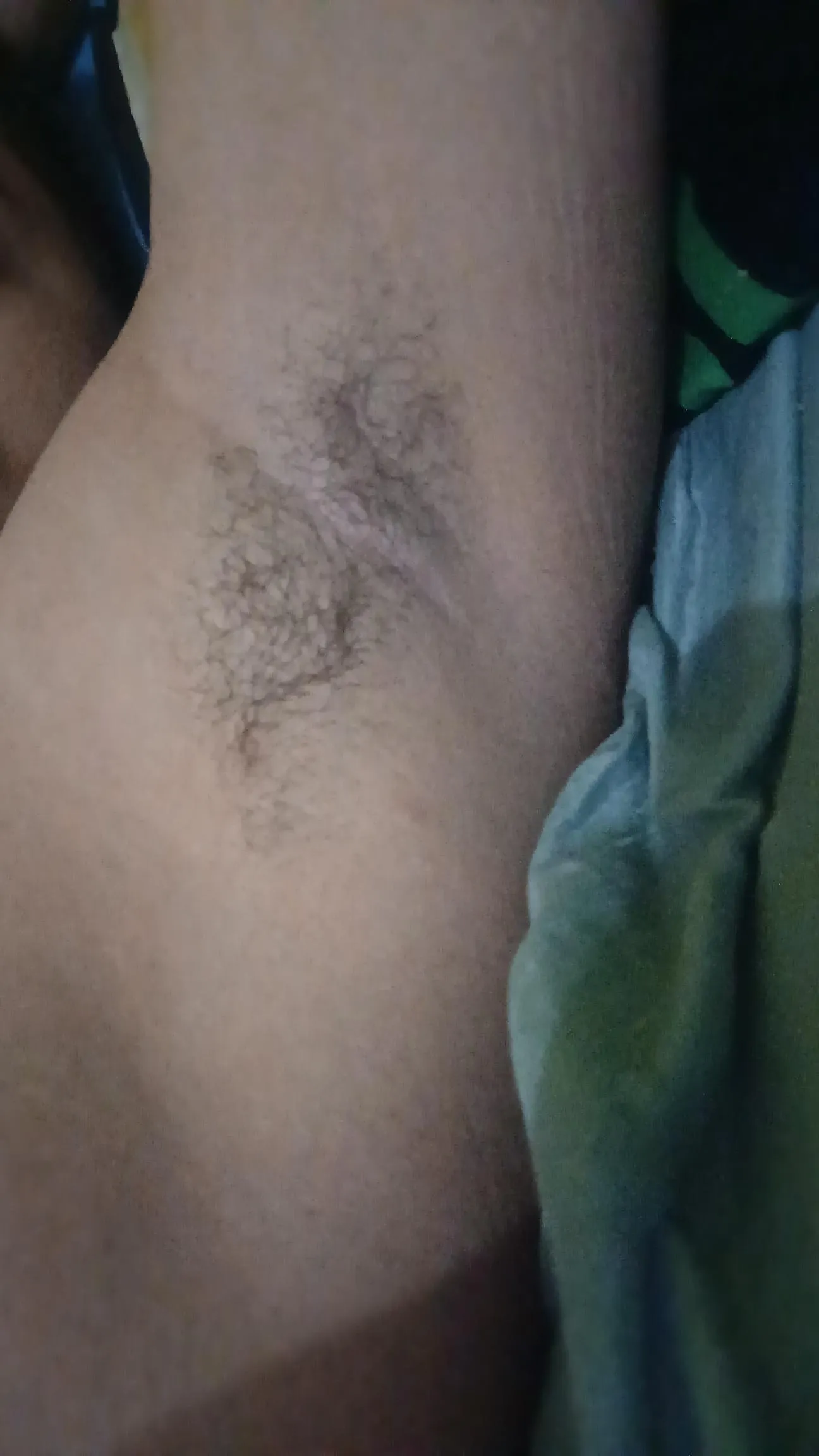 Hairy