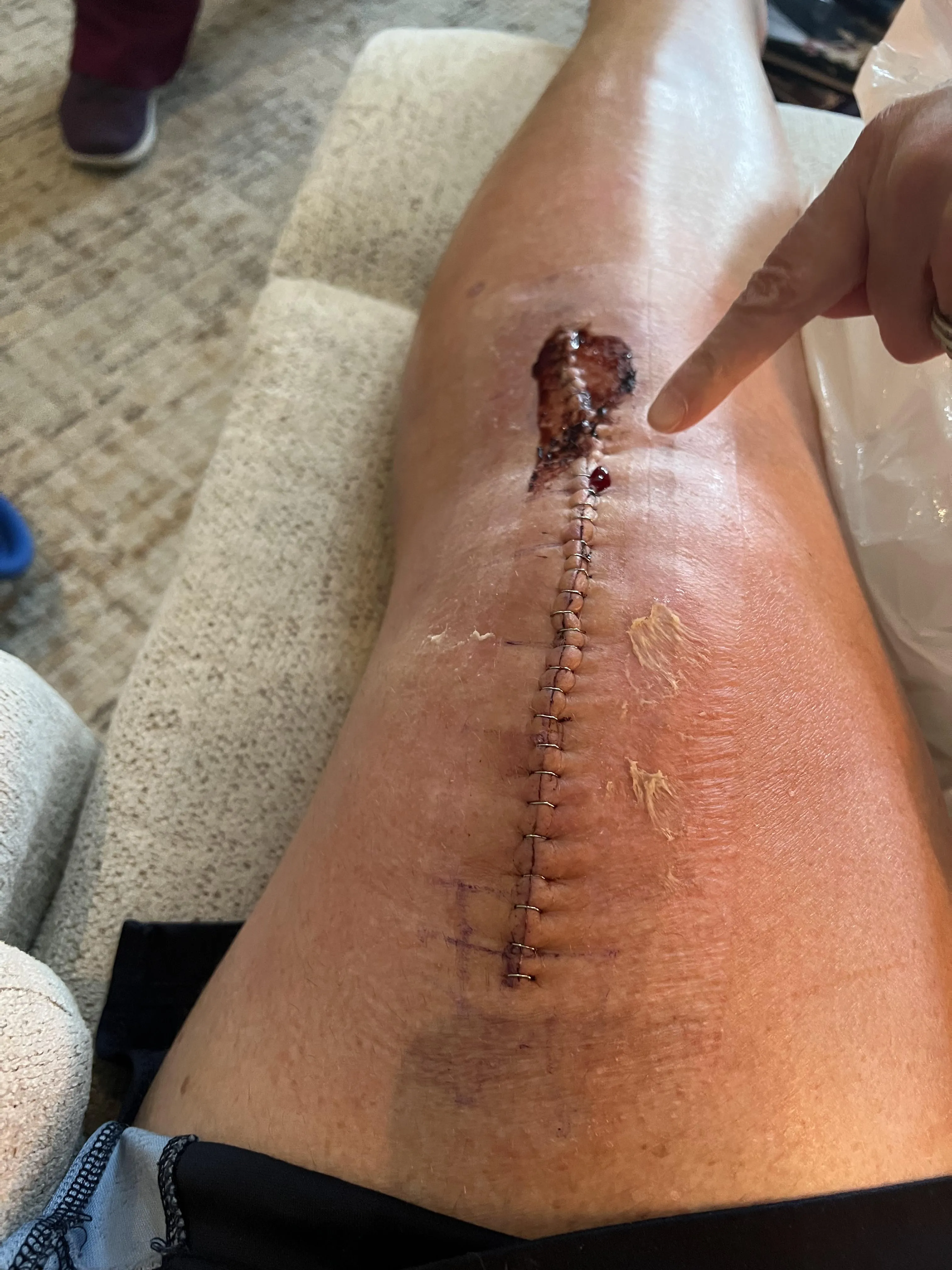 Is this gone too wild?