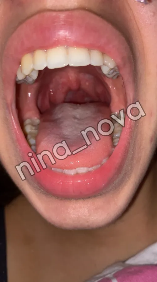 Last view before beeing swallowed {m}