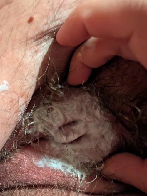 Messy with numbing cream on