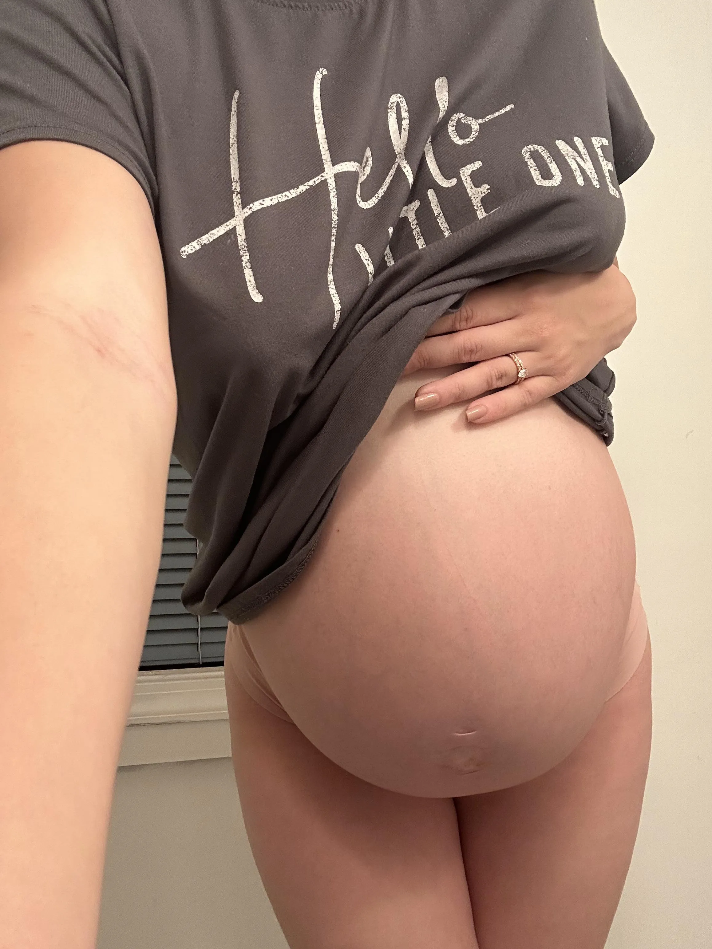 Wish someone would come help lift this bump up