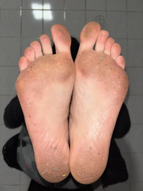 Would cat hairs bother you?