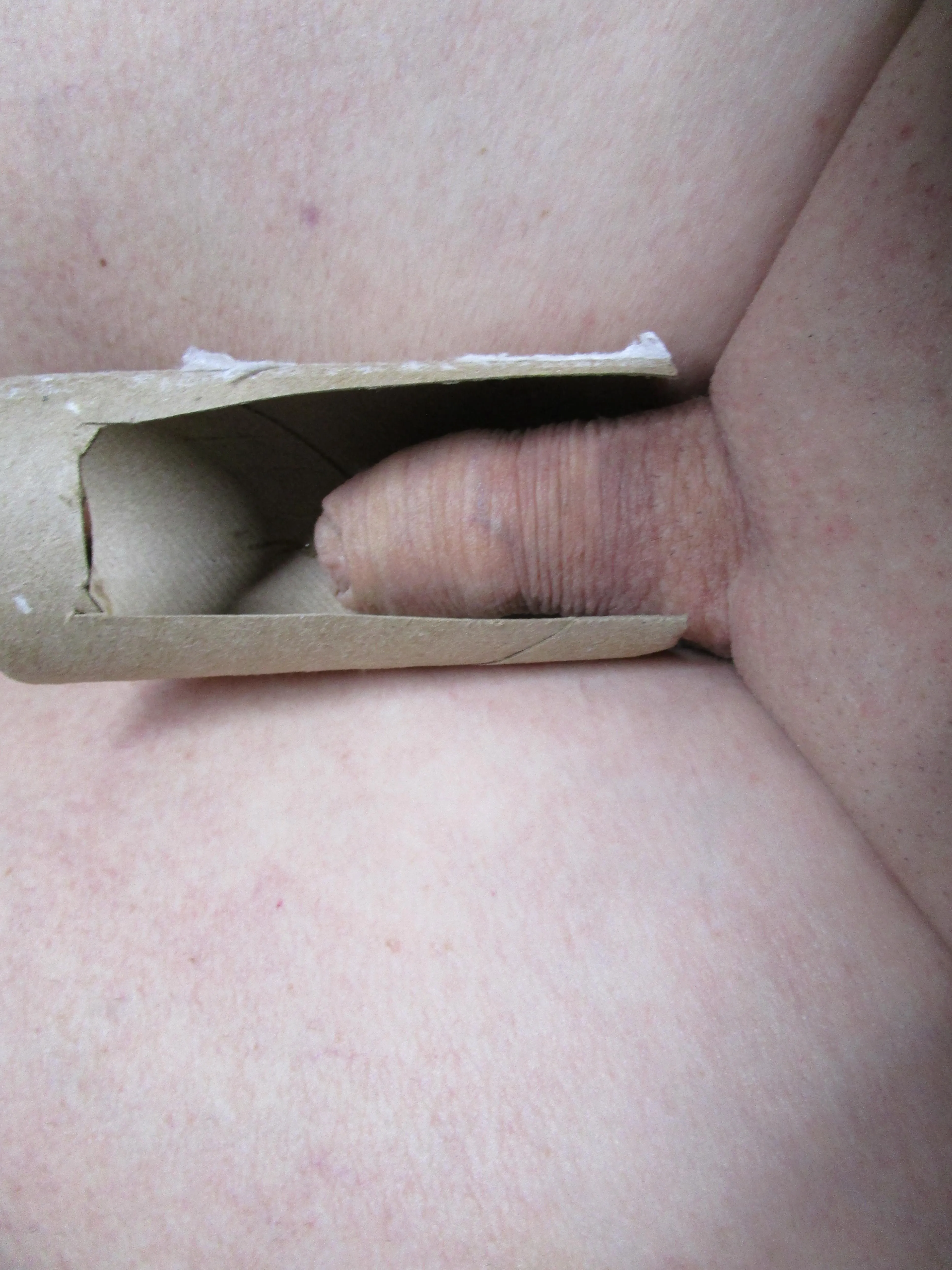 1 1/2 inches and 64 years old