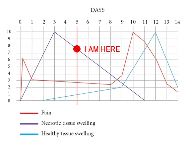 Five Days in VS Last Time