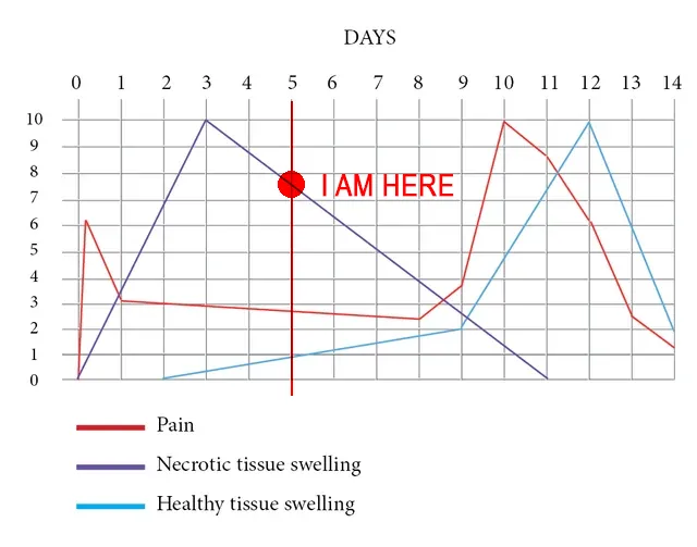 Five Days in VS Last Time