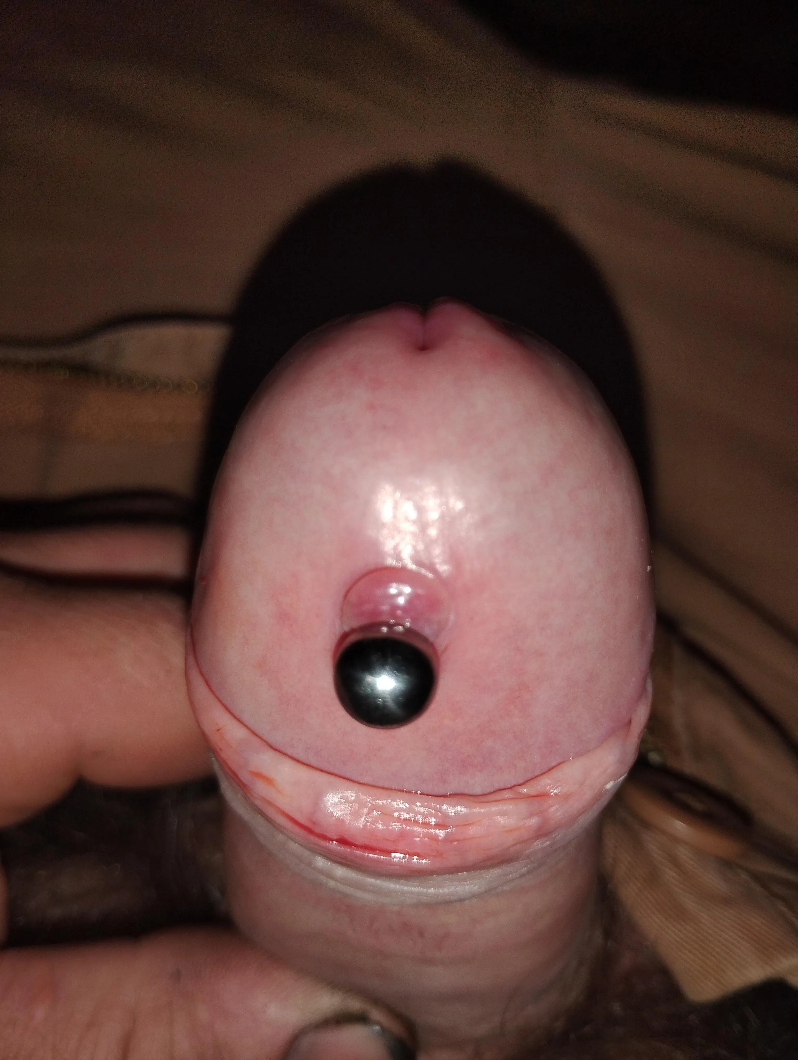 6 gauge apadravy bump