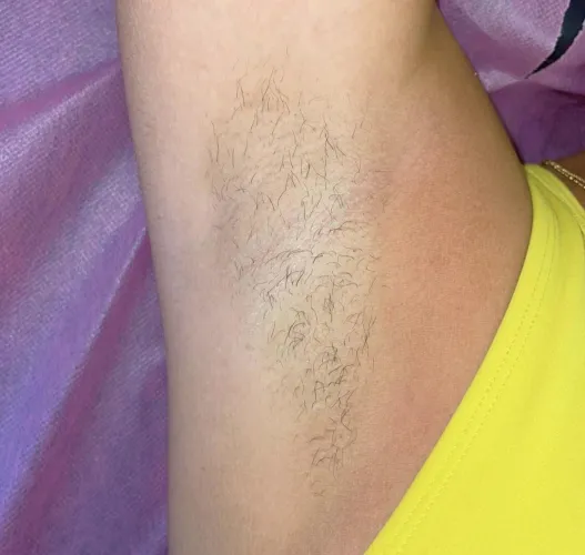 my armpits are better 😘