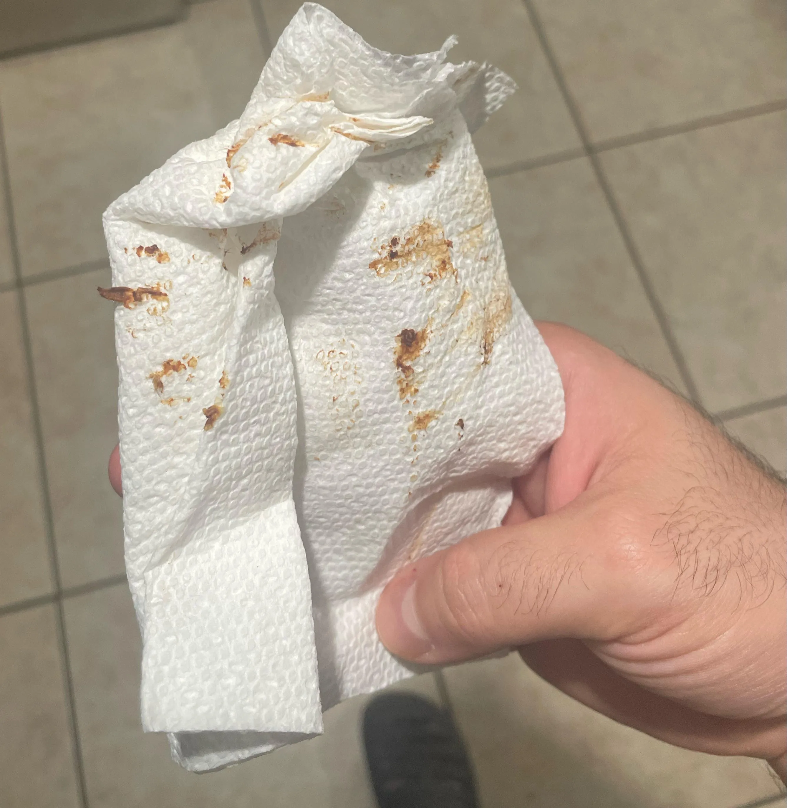 Earwax I cleaned out after swimming in the pool